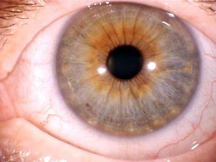 Iris straight on